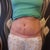 7 weeks po. this was taken the morning after 2 nights out drinking and dancing