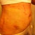 post op day 1, my stomach was a lil bruised, extremely sensitive and sore, and really swollen!