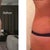 before and after at 6 weeks - VERY HAPPY