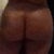 after 1st bbl but before Dr. S but this is almost my original butt no real change after 1st bbl