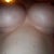 under breasts 3 weeks post op, getting softer