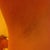 right armpit incision