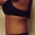 left side 13wks