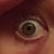 right eye after lasik 5/1/13
