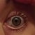left eye after lasik.....see the blood spots...apparently its normal,it's from the suction :/