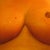Day 16 Post Op.