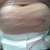 post op MOMMY MAKE over- day 1-3 before the first shower, the only attachment you are missing is my urine catheter- which was a great thing to have even though its not typical.