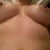 under view..scars minimal and barely visible