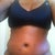 5 weeks PO