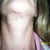 Chin scar and loose skin on neck