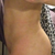 3 weeks post op
