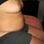 4 days before surgery - sitting down/side view of belly blob