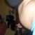 before smart lipo side angel