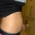 3 weeks post, hopefully it flattens more
