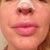Day 2: Front view nostrils and tip look good so far