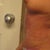 after revision upper abd lipo (11 weeks post TT)