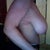 right boobie pre op
