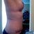 8.5 weeks PO