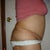 3 weeks 2 days post right
Really swollen... Was really ACTIVE today
Got My Period today so I could also be Bloated