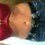2mo.3wks. jeans 
I tanned just covered BB w/ a penny 7 covered scar