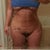 day 8...sorry for the dirty mirror, lol...tummy is flat, he made my hips even but my right leg is longer than the other so that hip always has sat higher