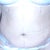 stomach 3 days post op