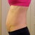 "Before" photo.  My muscles were not holding anything in.  I could tighten my abs and that belly would go away, but this was normal standing, relaxed position.  100 pounds, size 0-2.