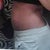 Swollen but no more hanging belly.
