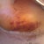 My left side is extremely tender!  I keep having to tell my daughter to be careful around mommy