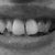 Top Teeth