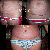 before and after ~ after photo taken 3 weeks post op ~ wow makes me cry ~ LOVE the NEW me :)
