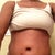 60 days PO; still a bit swollen but mostly later in the day