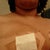 non stick gauze pad to protect nipple from rubbing