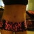 21 days PO, I just took off my binder, so I have some marks from that.. other wise i think it looks pretty good!  Wondering  if the swelling goes down will my stretch marks look less noticeable.