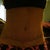 21 days PO, again, most of the marks are from the binder.. Since I've been massaging my tummy, incision ridge has gone down.  Very happy so far!
