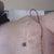 Day 3 Post Op!