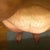 my left side is larger because I have scar tissue from my c-section