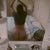 almost 6 weeks..left cheek is still a little smaller but it doesn't bother me..they were uneven from birth lol