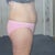  1 day before SmartLipo