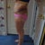 5 days after SmartLipo
