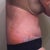 Day 8 Noticed my bra goes so far up my back that it doesn't even fit underneath my breast because in so hunched over
