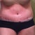 Day 8 See the R & L unevenness? See that weird dimple in the upper right?