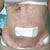 After Day 1 Stomach