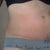 8 WEEKS right side