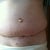 Little muffin top, hopefully mostly swelling.