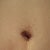 my bellybutton's scabs have fallen off. I like that the scar is small and 'inside.'