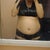 before my proecdure  belly