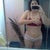 3 days after my liposuction procedure :)