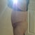 Left side 9 days post op. The apron is GONE! WooHoo!