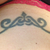 Here is a week after 1 stomach treatment.  I'm trying to find my before pic and will ask Caddell's if they might have one to email me.